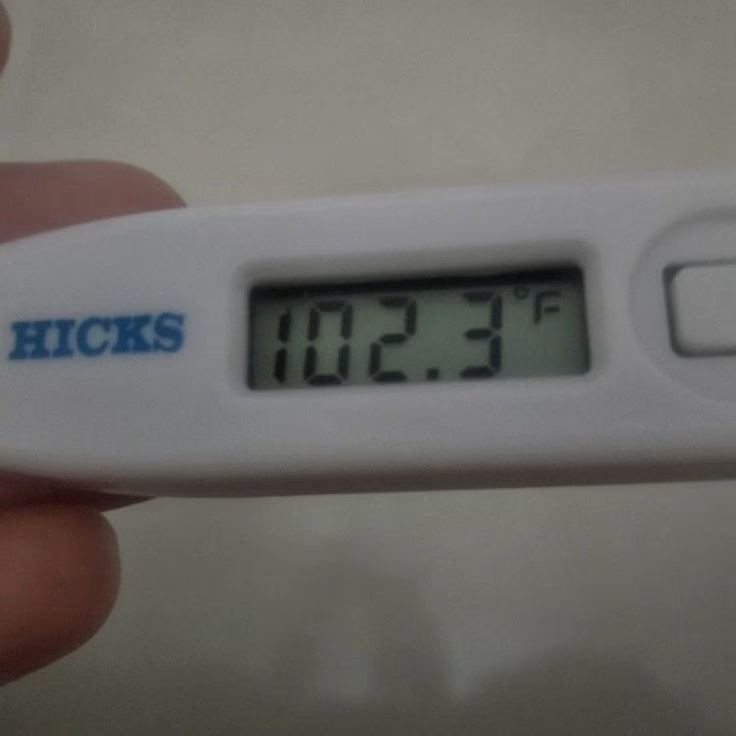 What should I do if I have a fever of 103?