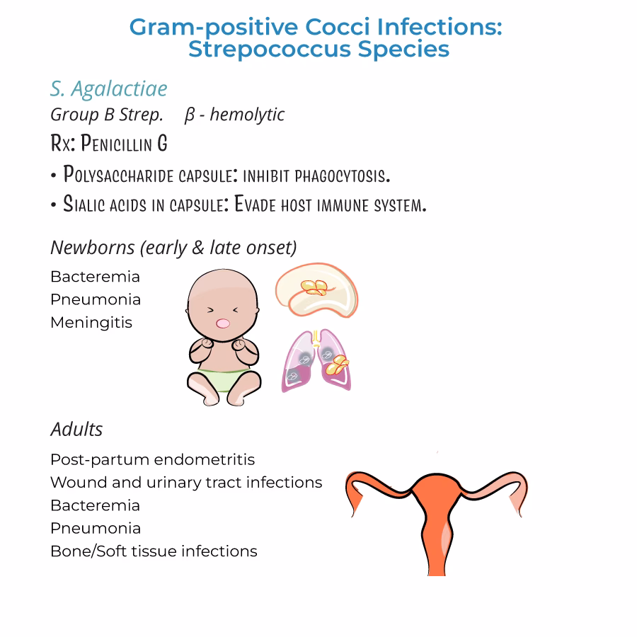 What is Group B streptococcal infection?