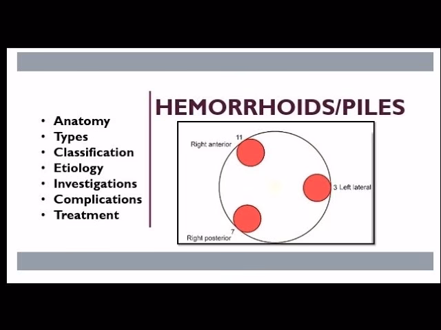 Does Doctor Butler's foam cushion work for hemorrhoid relief?