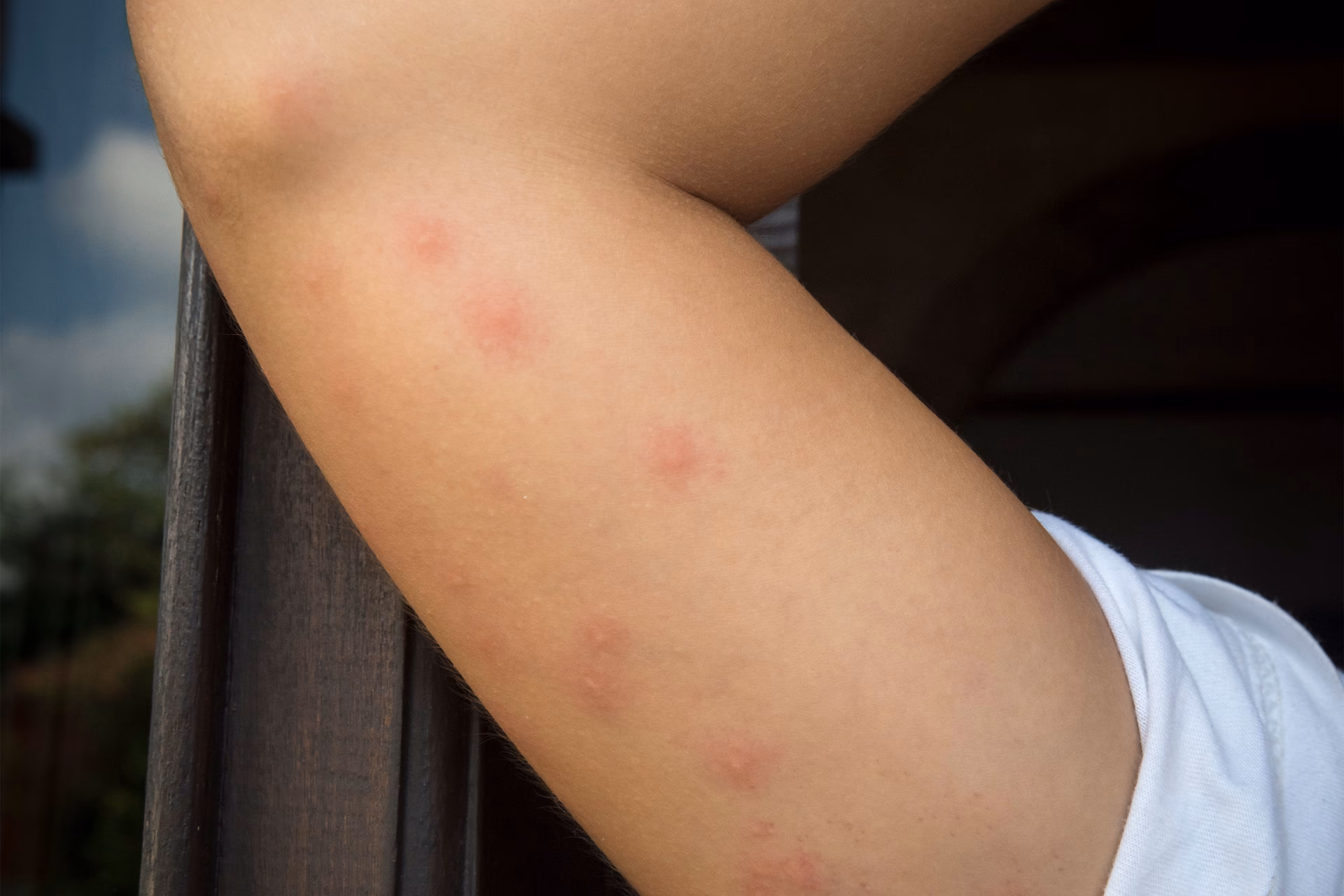Why do hives come back every 6 weeks?