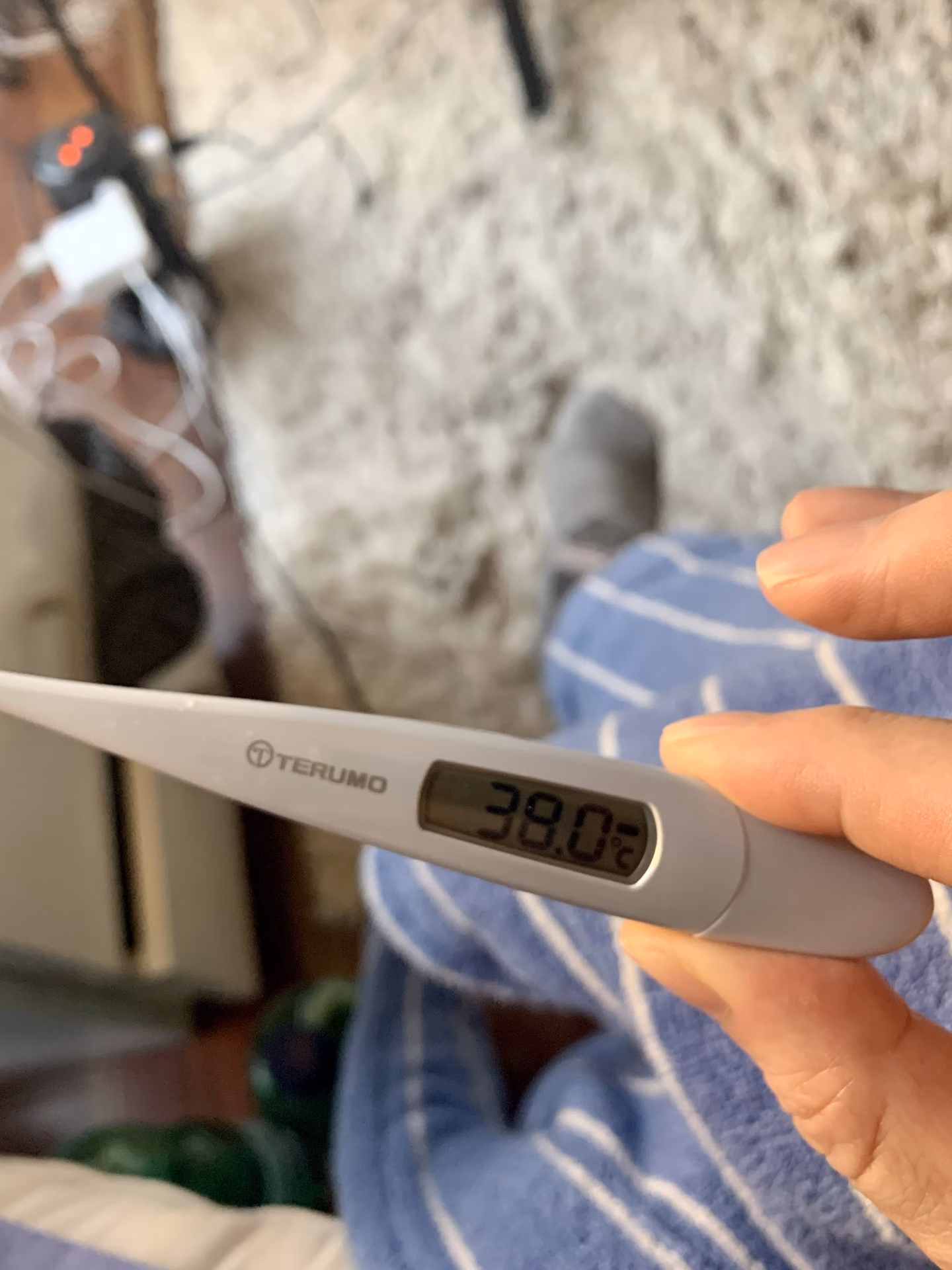 What if a baby has a fever above 38°C?
