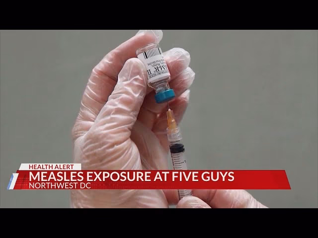 How many people died from measles?