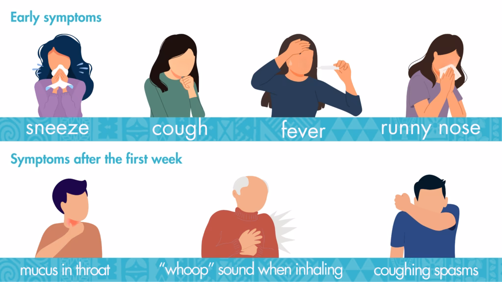 How do you know if a person has whooping cough?