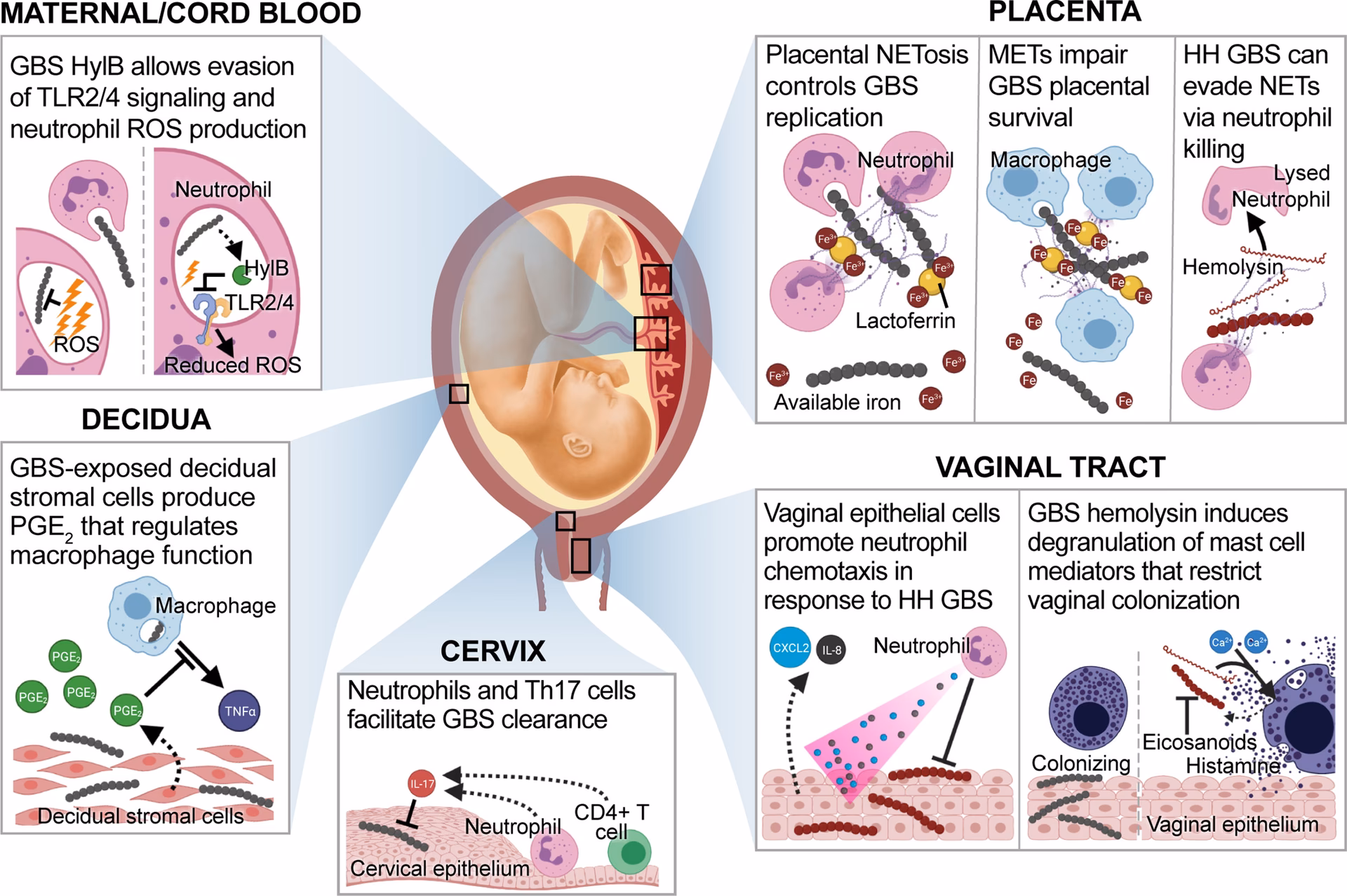 Can A Streptococcus agalactiae infection cause chorioamnionitis?