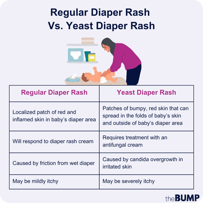 Can a baby get a yeast infection?