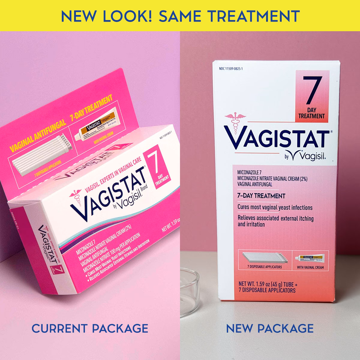 How do you treat a yeast infection during pregnancy?