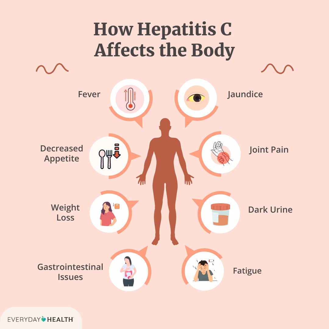 Is hepatitis C a long-term infection?