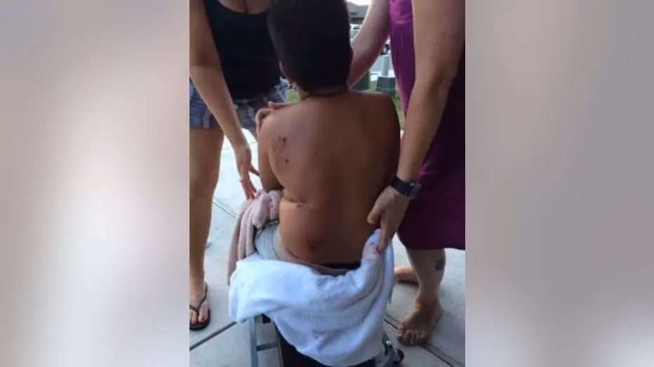 Could rabies sneak back into the US?