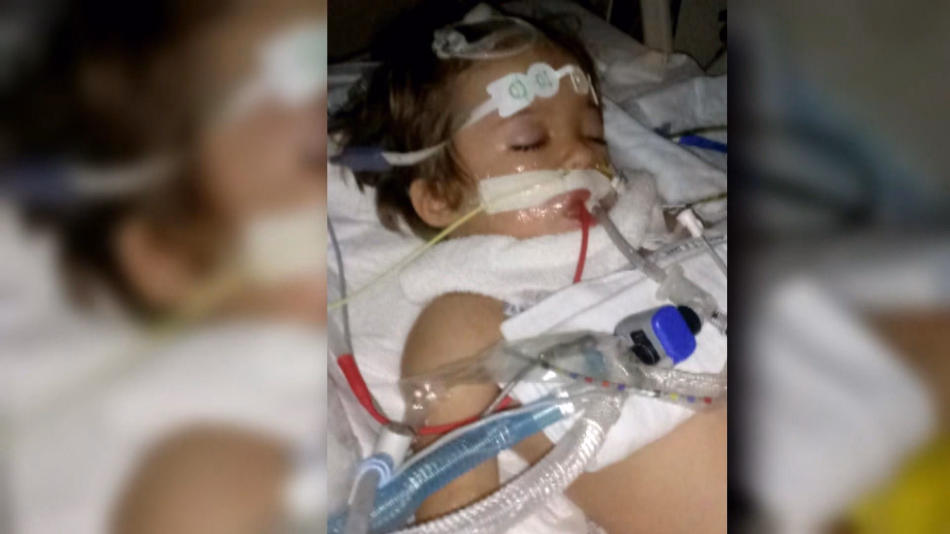 How do I know if my child needs rabies treatment?