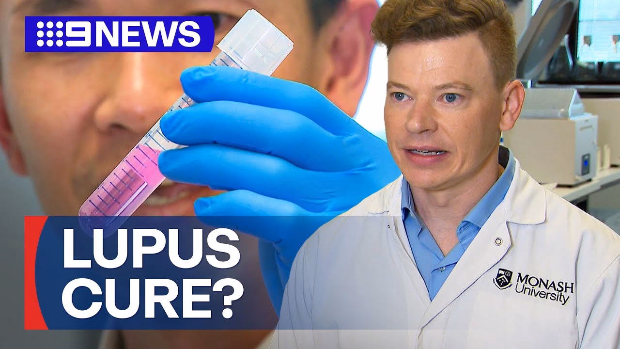 Can Monash Health treat lupus?