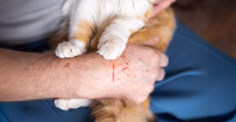 Can a cat scratch cause rabies?
