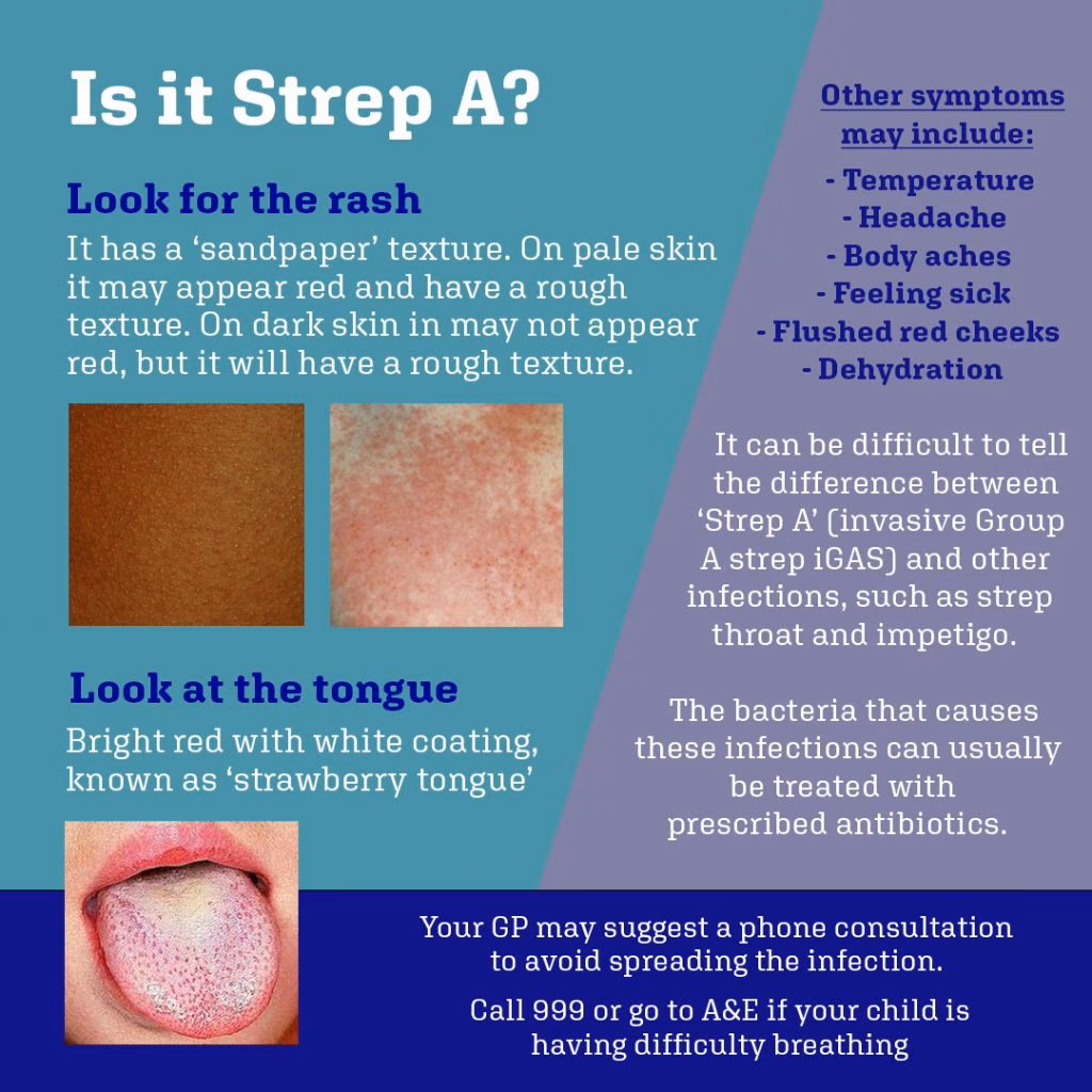 What are the symptoms of Group A streptococcal infection?