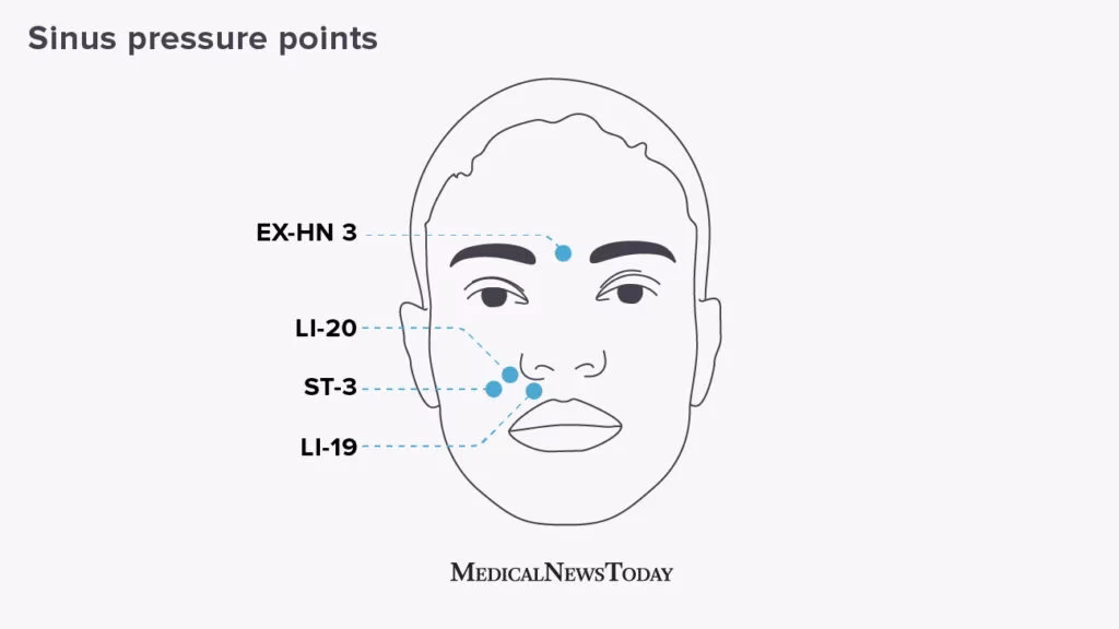 How often should I get acupuncture If I have allergies?