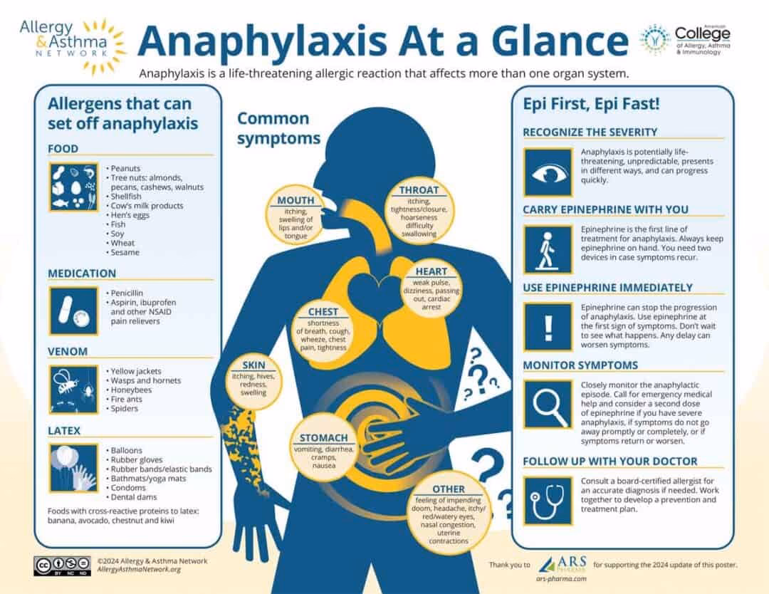 How do you administer im adrenaline in anaphylaxis?