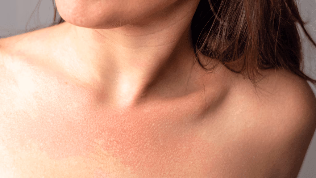 Was sind die Symptome einer Alkoholintoleranz?