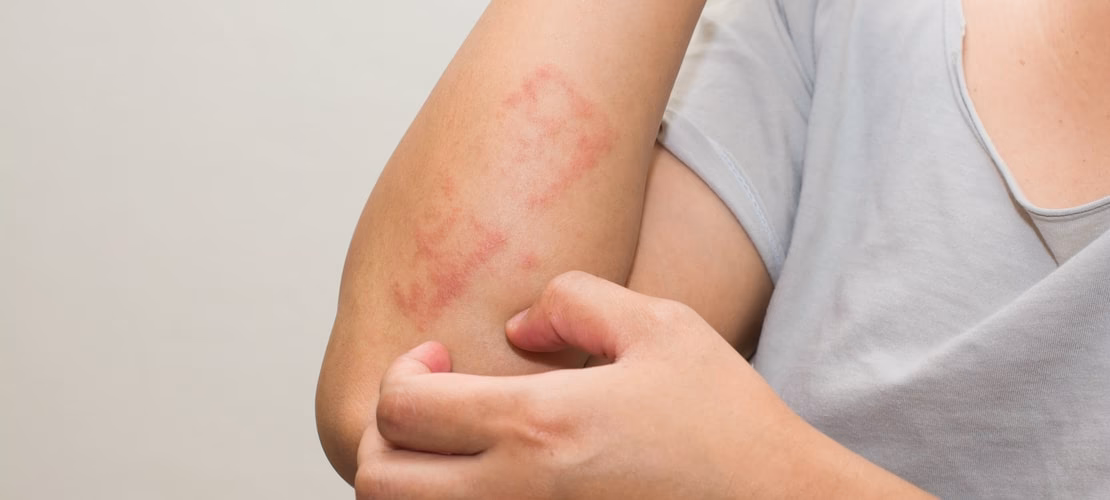 Où trouver des acariens dans la maison ?