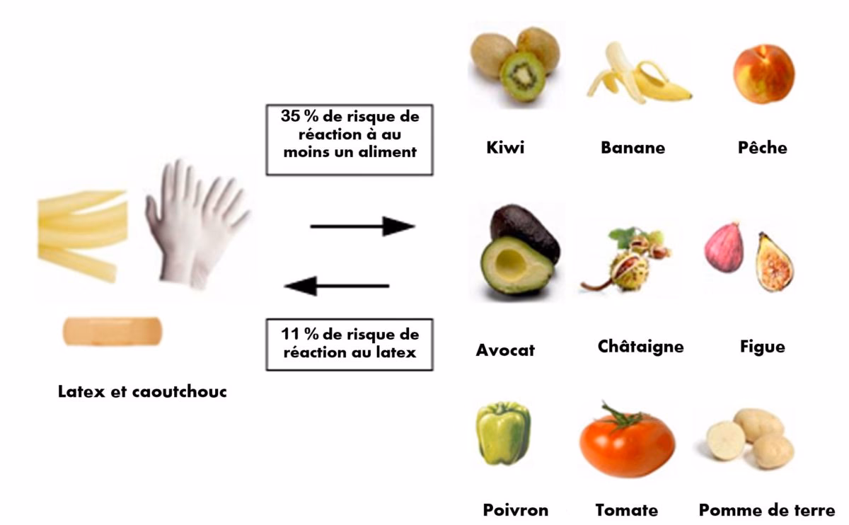 Qu'est-ce que les allergies aux fruits et légumes ?