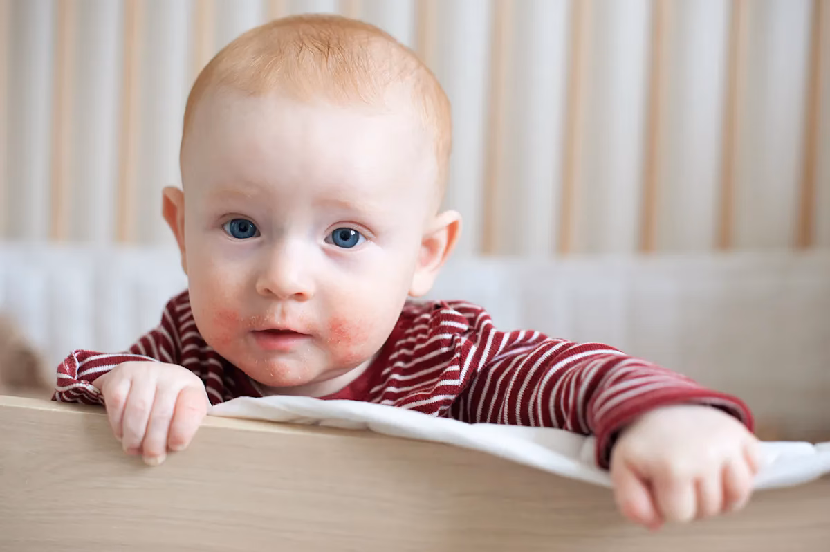 Quels sont les symptômes d’allergies respiratoires chez un enfant ?