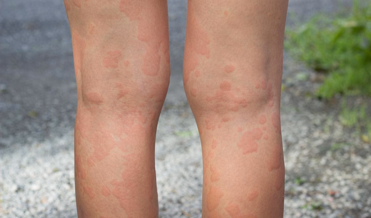 Quels sont les effets secondaires de la nicotine ?