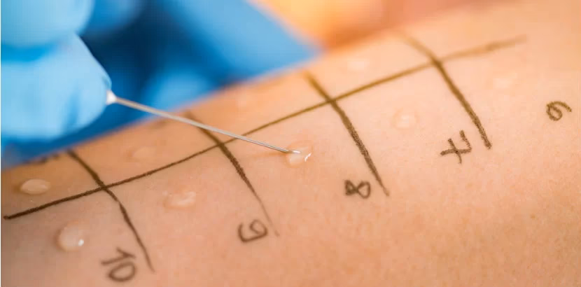 Wann ist eine Allergiebehandlung erforderlich?