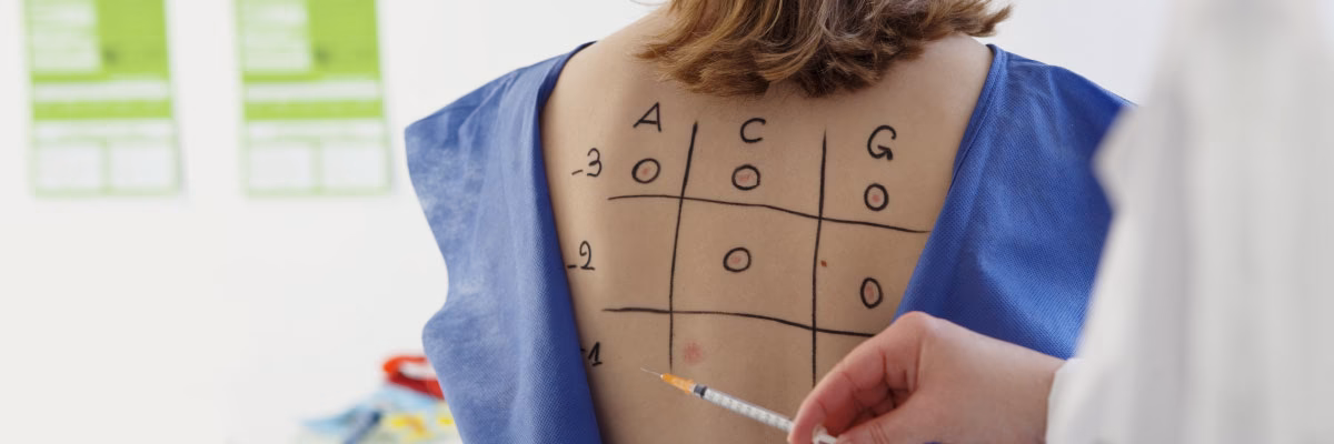 What is an allergic reaction?