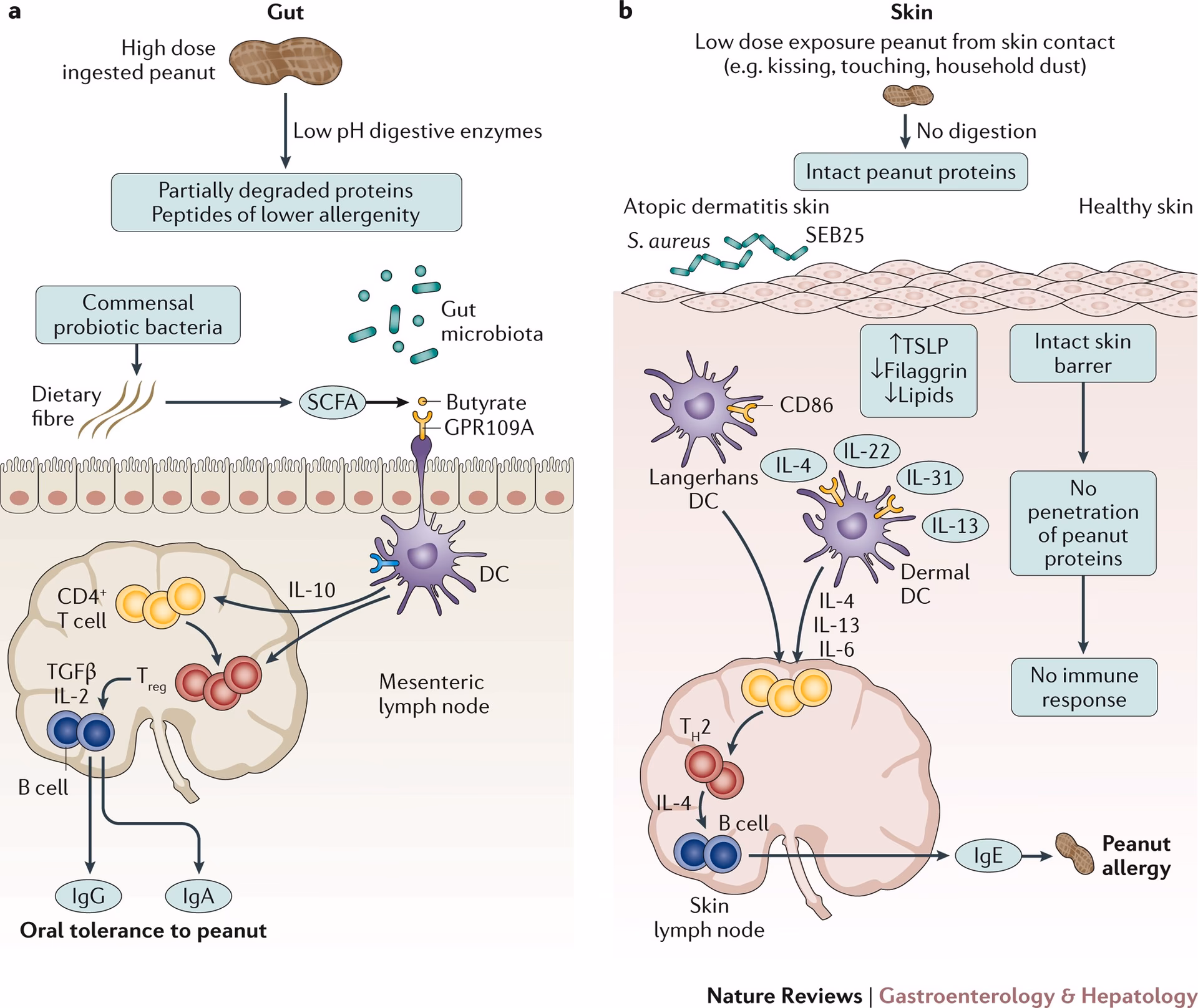 What is the most common food allergy diagnosis?