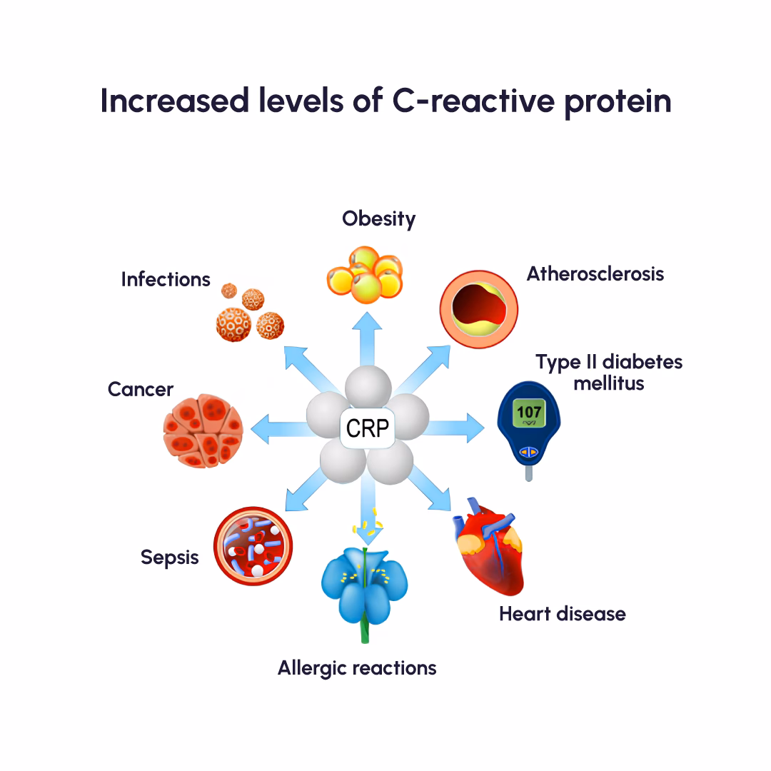 What does a high C-reactive protein level mean?