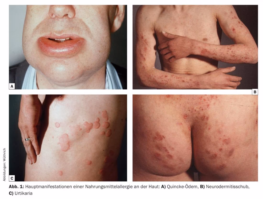 Est-ce que les arachides sont dangereuses pour les enfants ?