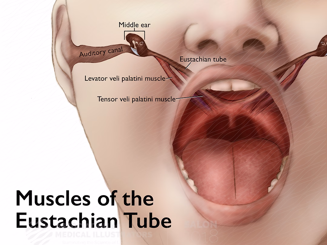 Can allergies cause Eustachian tube dysfunction?