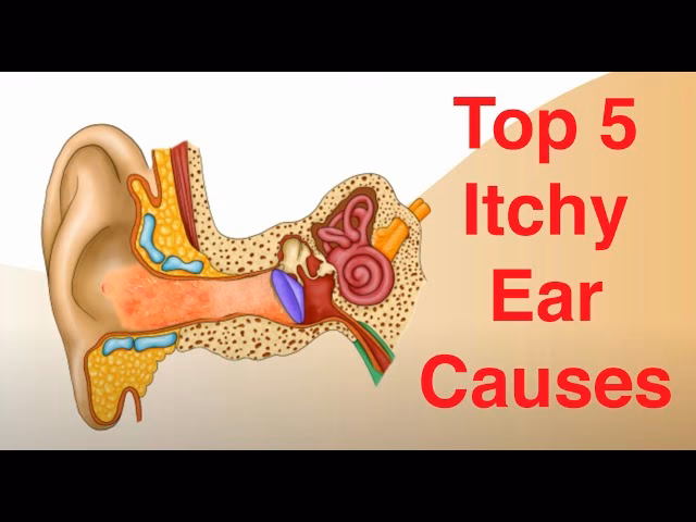 Does earwax cause itchiness?
