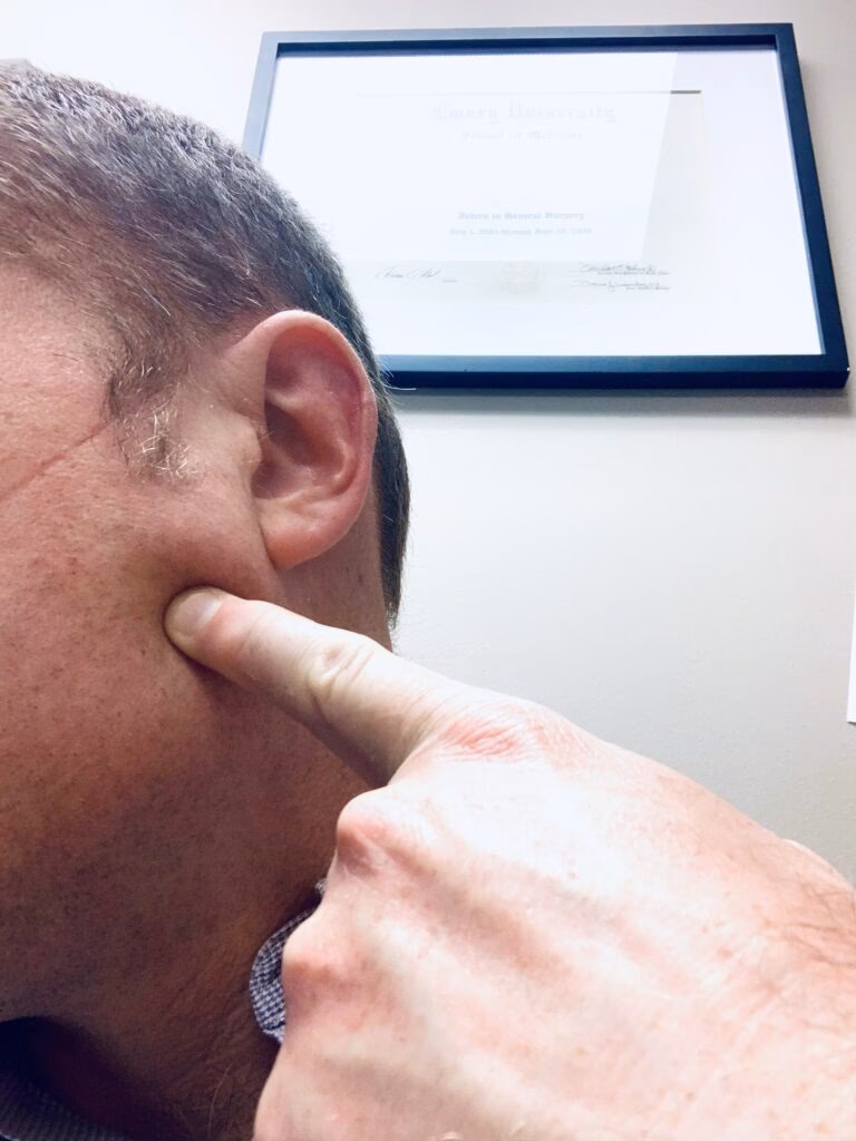 What are salivary gland problems?