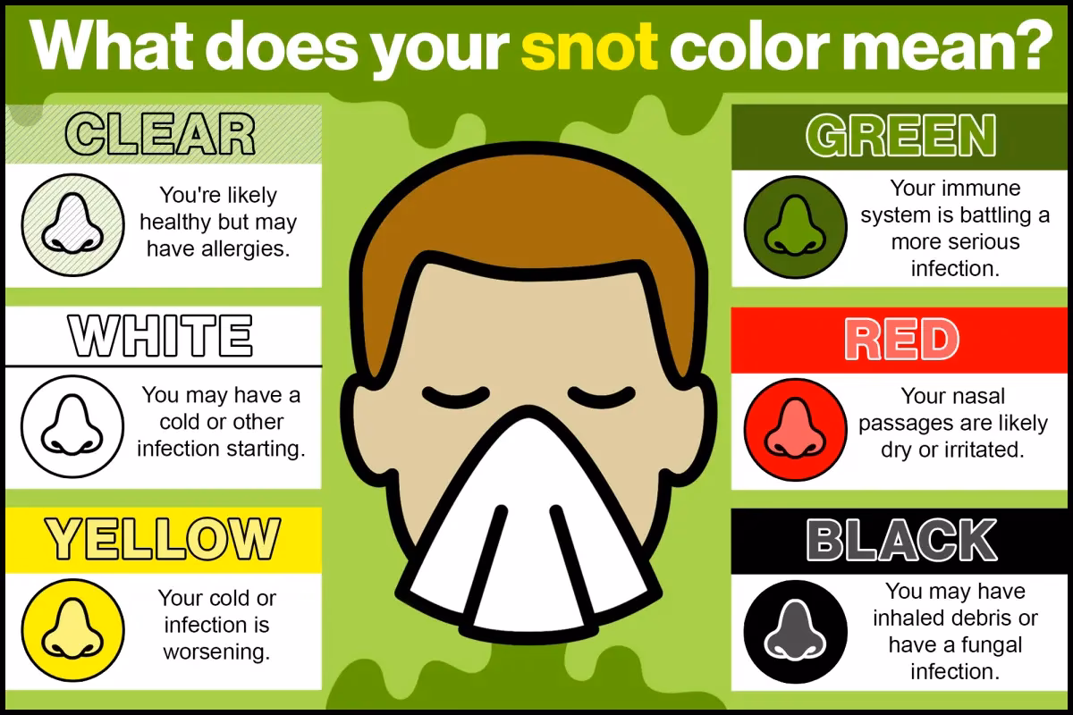 What does Yellow Snot mean?