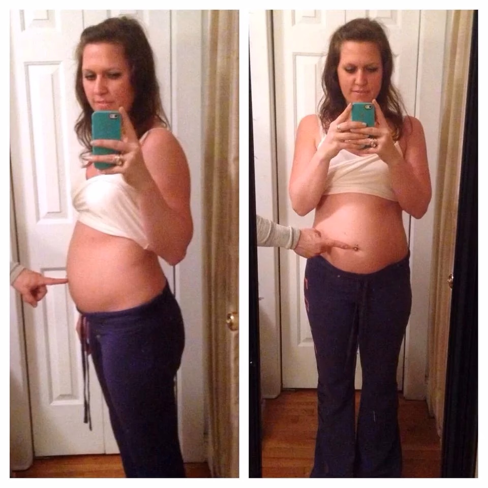 Is bloating a food intolerance?