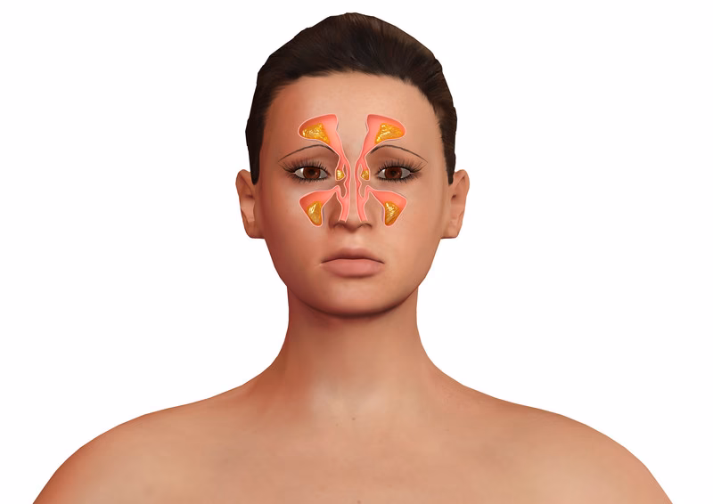 What is the relationship between histamine intolerance and brain fog?