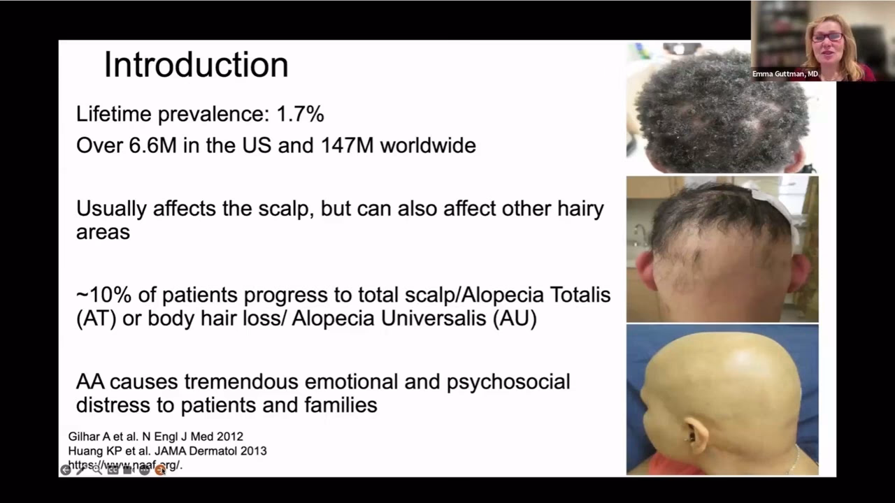 Can environmental factors cause hair loss due to allergies?
