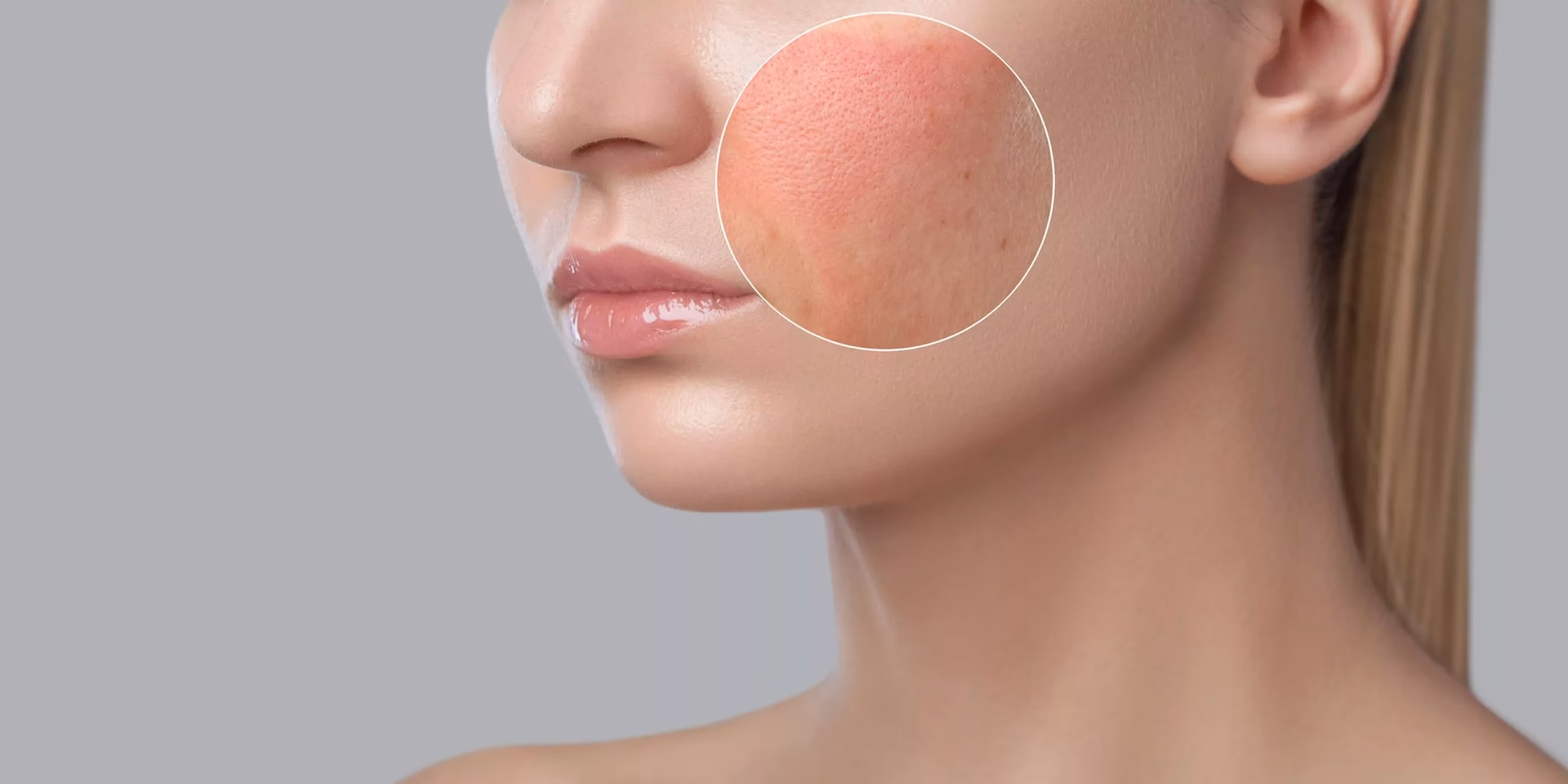 What are the symptoms of an allergy rash on the face?