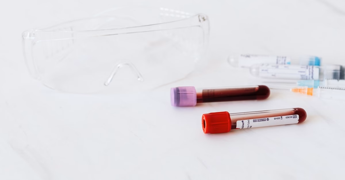 What is the allergy service?