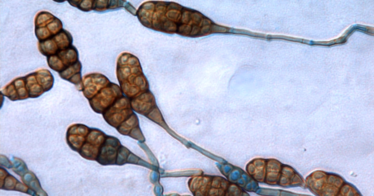 Does Alternaria alternata cross-react with food allergens?