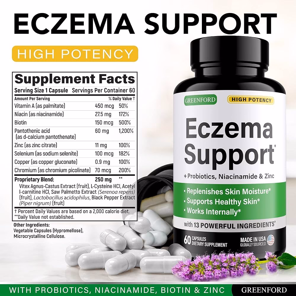 What are the best holistic eczema treatments?