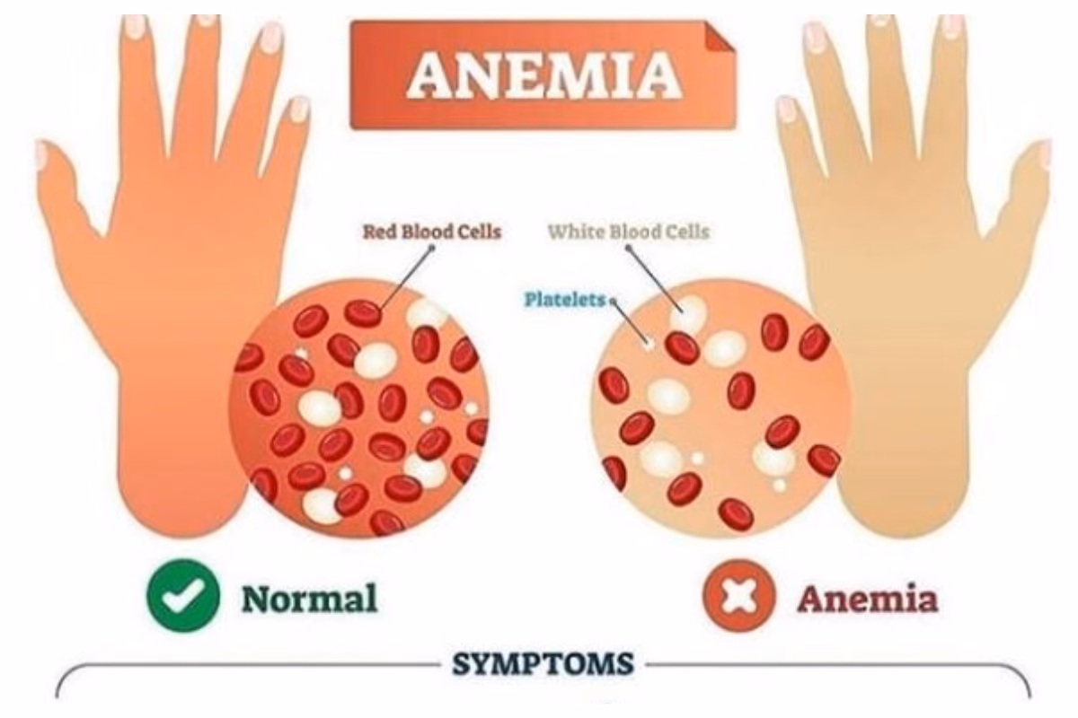 What is low risk anaemia?