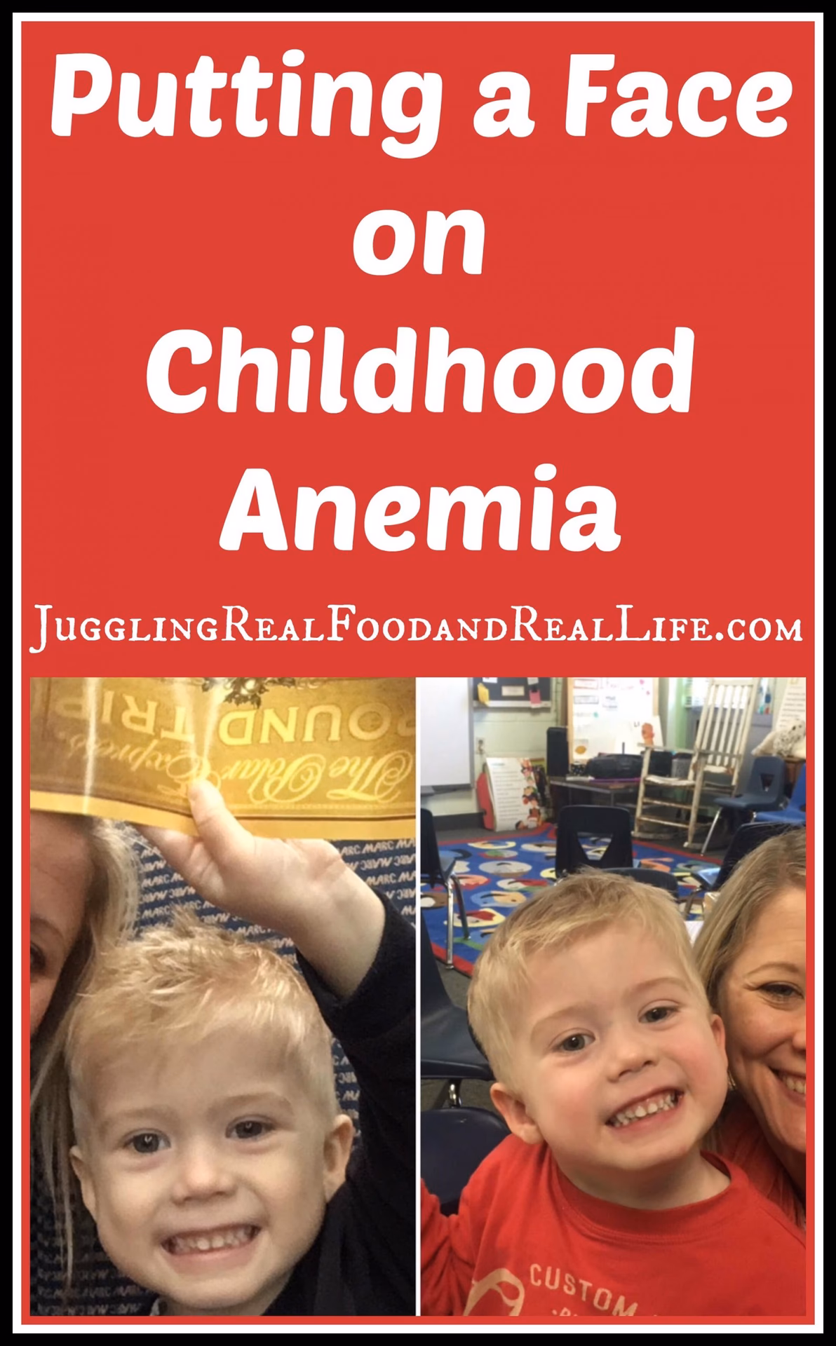 How common is anemia in children?
