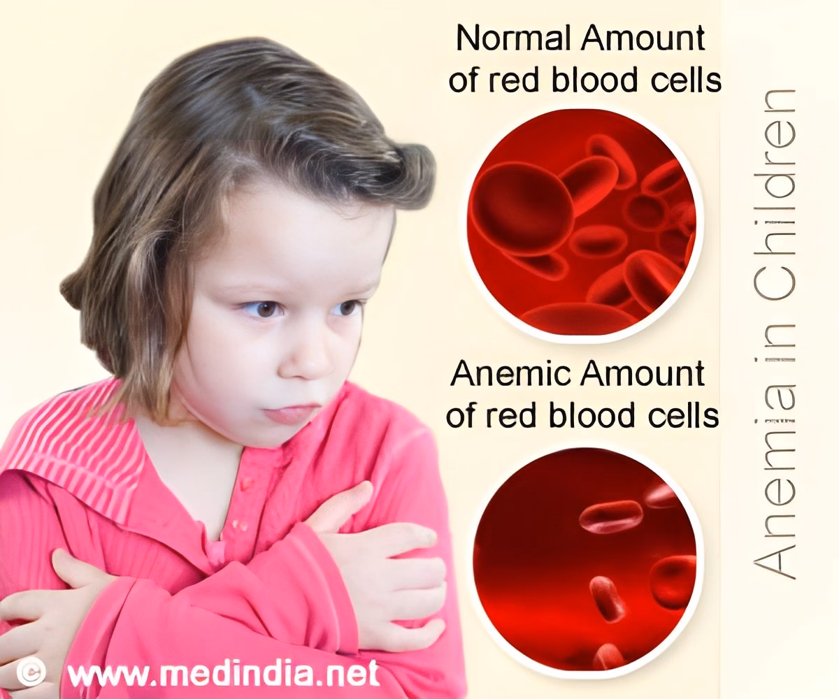 What are the symptoms of anemia in children?