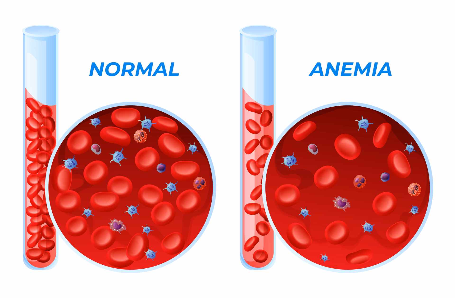 How many anaemia pictures are there?