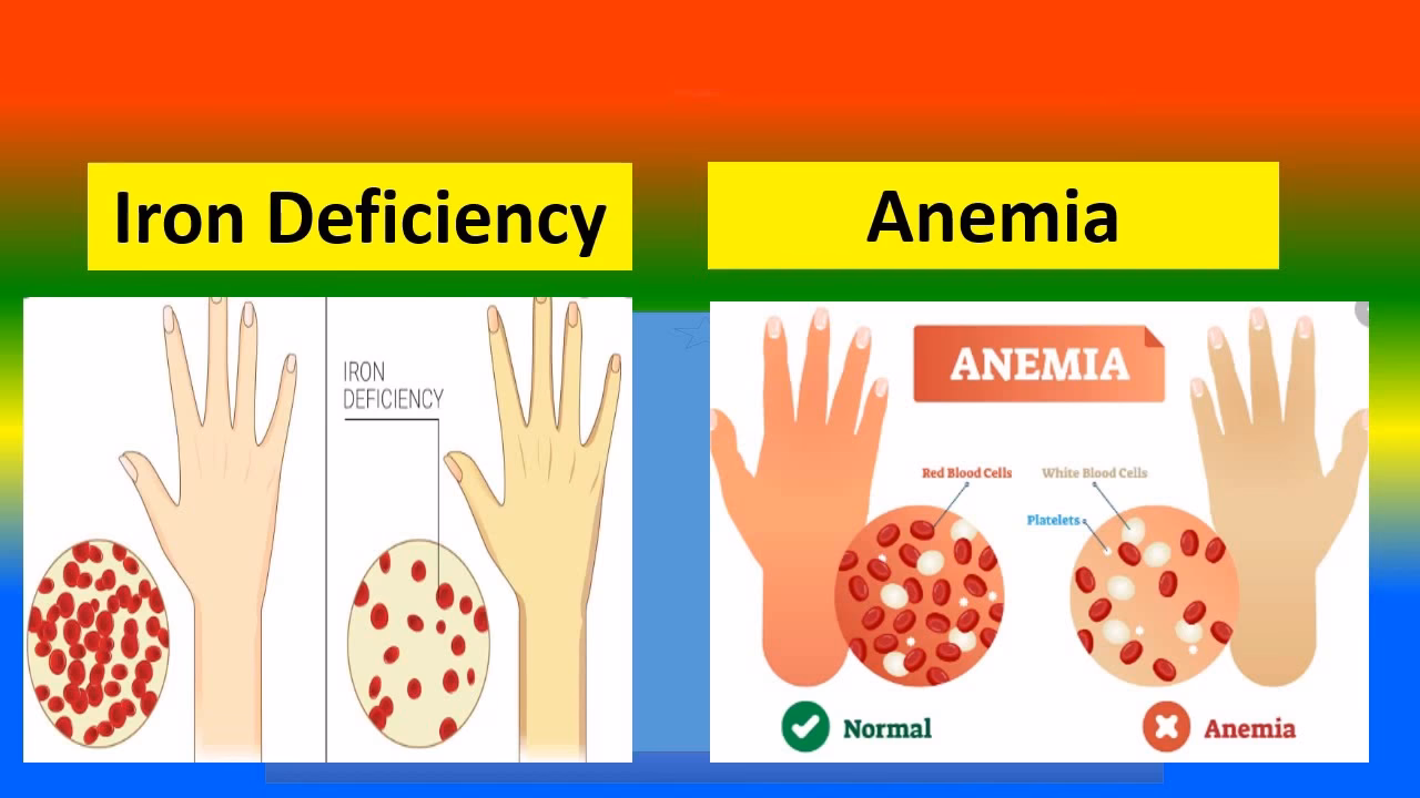What causes anemia?
