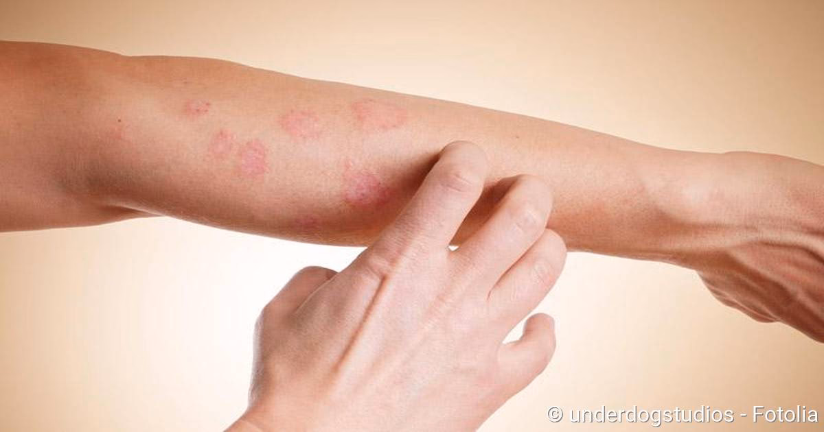 Was sind die Nebenwirkungen von Antibiotika?