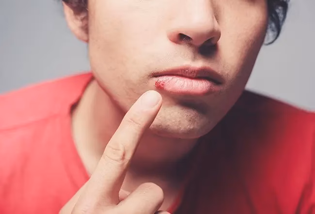 Can anxiety affect your lips?
