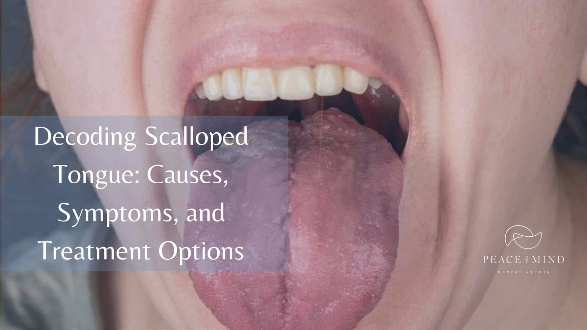 Can anxiety cause a burning tongue?