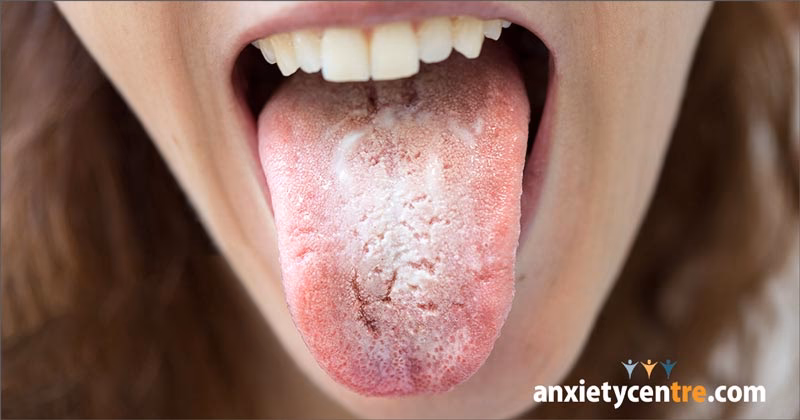 How to manage anxiety tongue?