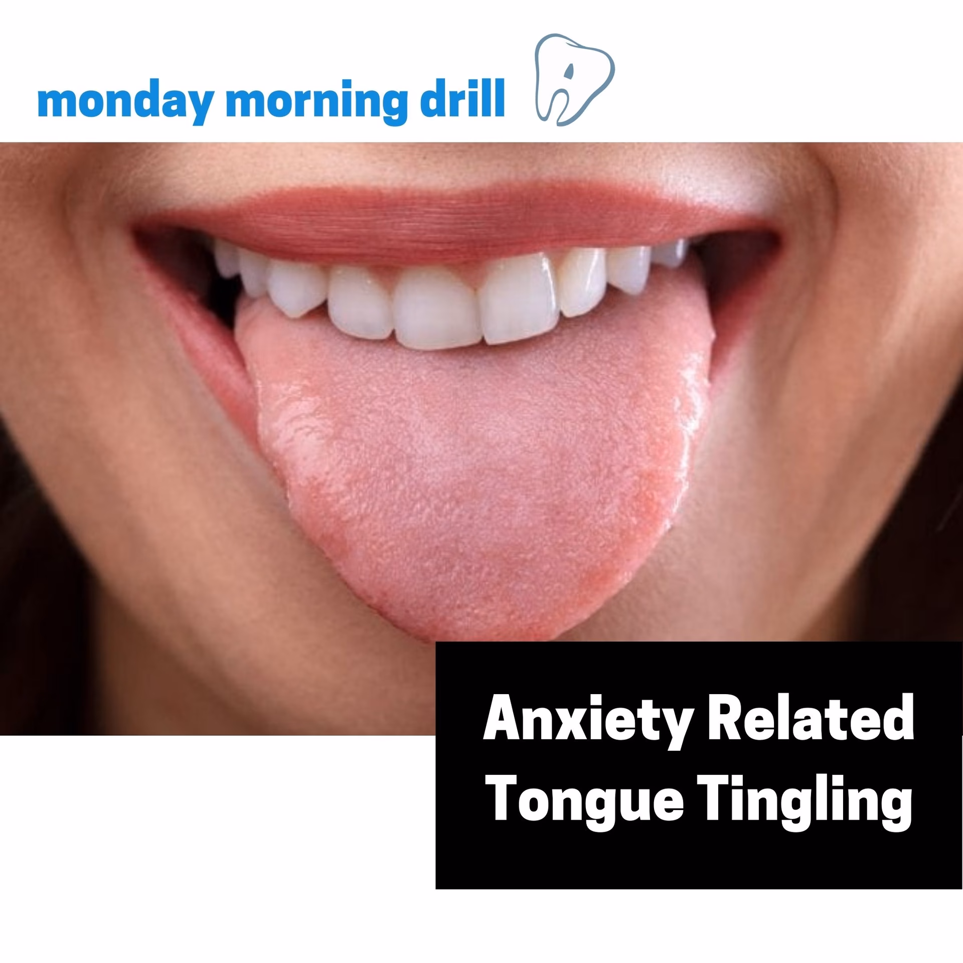 What does anxiety tongue feel like?