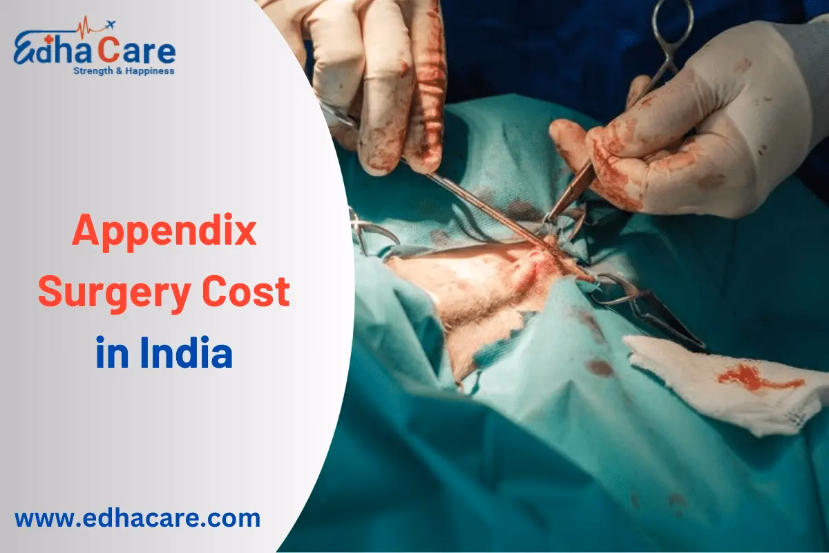 Is appendicitis surgery expensive?